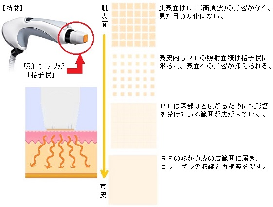 GFRしくみ
